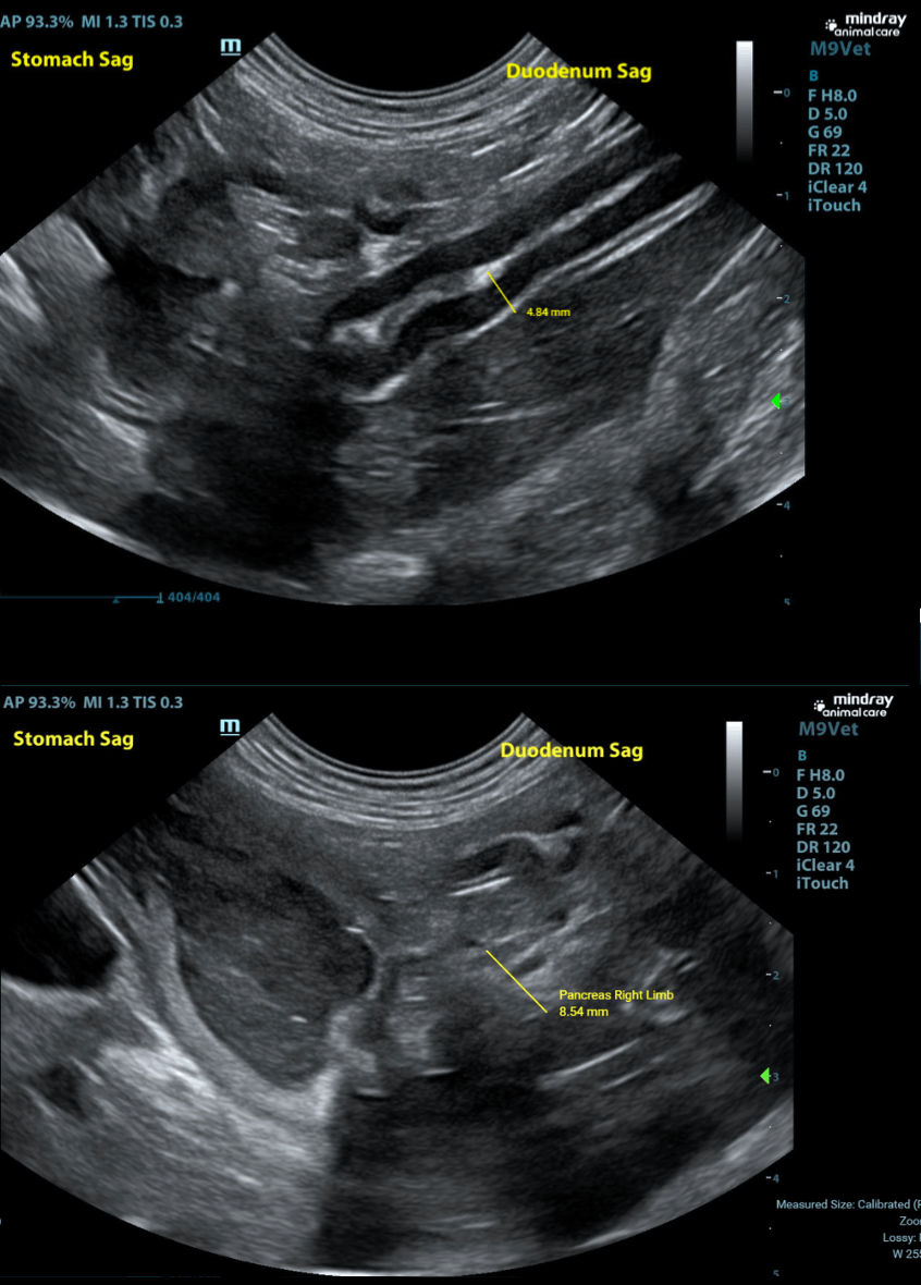 Duodenum_Pancreas