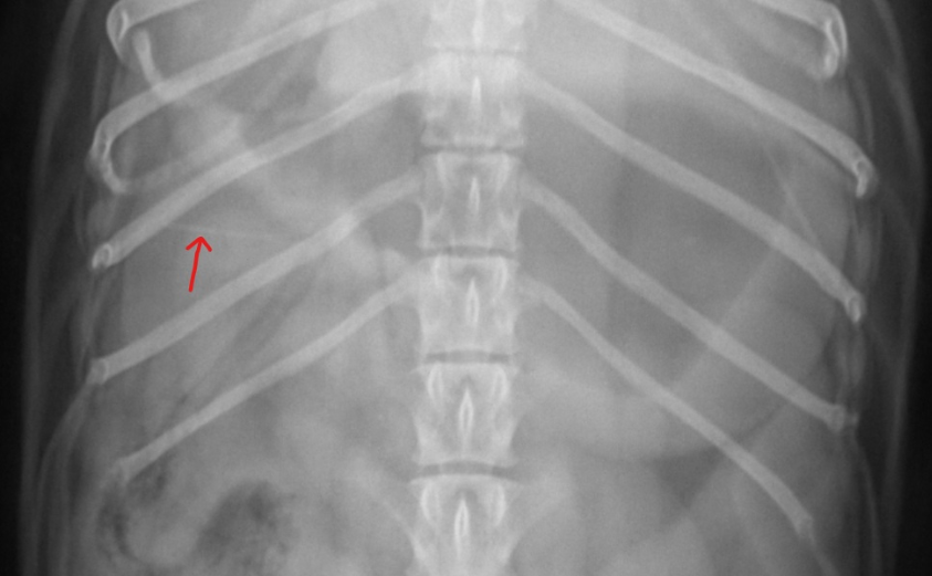 RAD - Collaborative Imaging A Team-Based Approach Resolves Complex Gastric Distress
