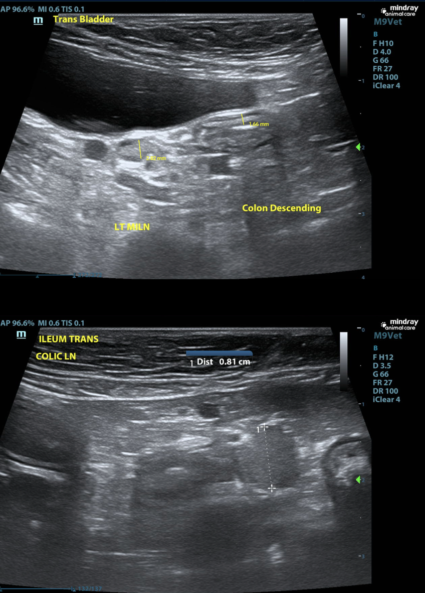 US - Trans Bladder - Ileum - Collaborative Imaging A Team-Based Approach Resolves Complex Gastric Distress