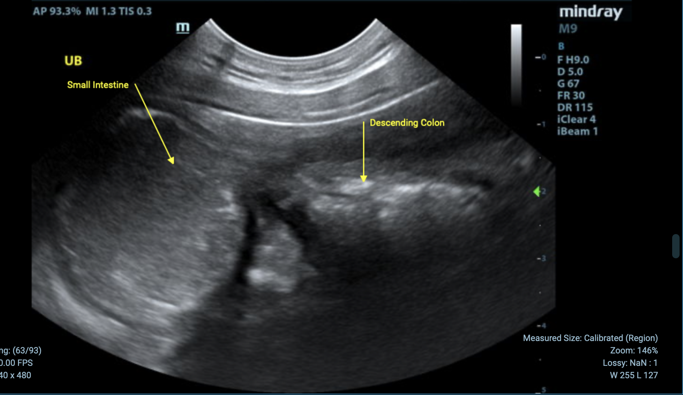 Urinary Bladder