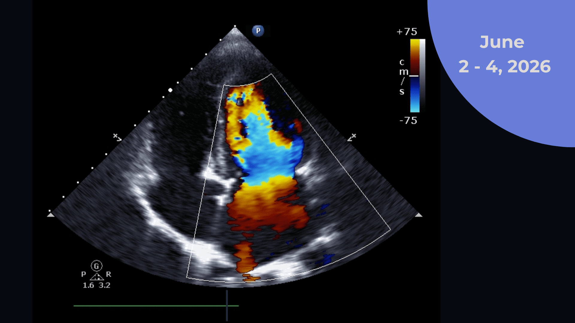 Veterinary Cardiology Echocardiography Training - June 204, 2026