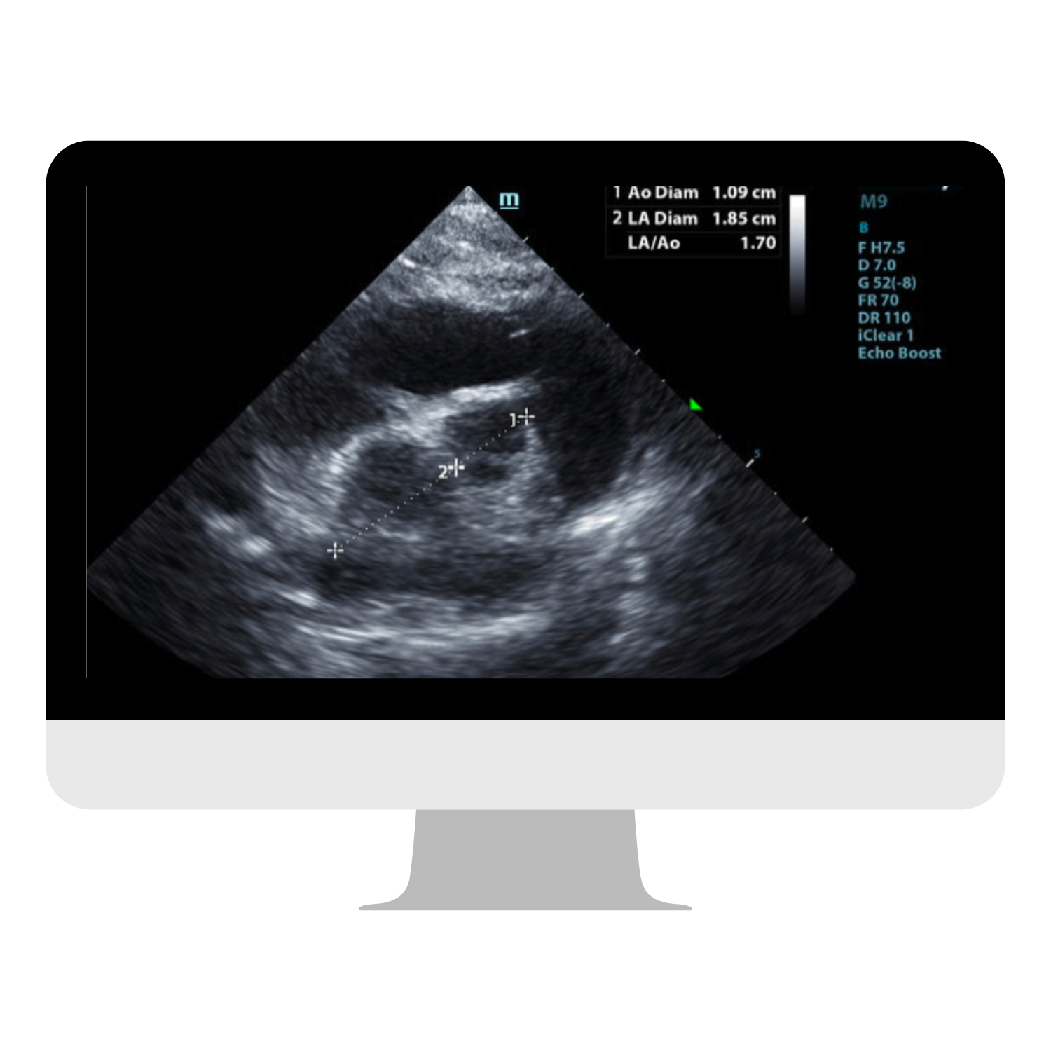 Echo - Cardiology Read - K9