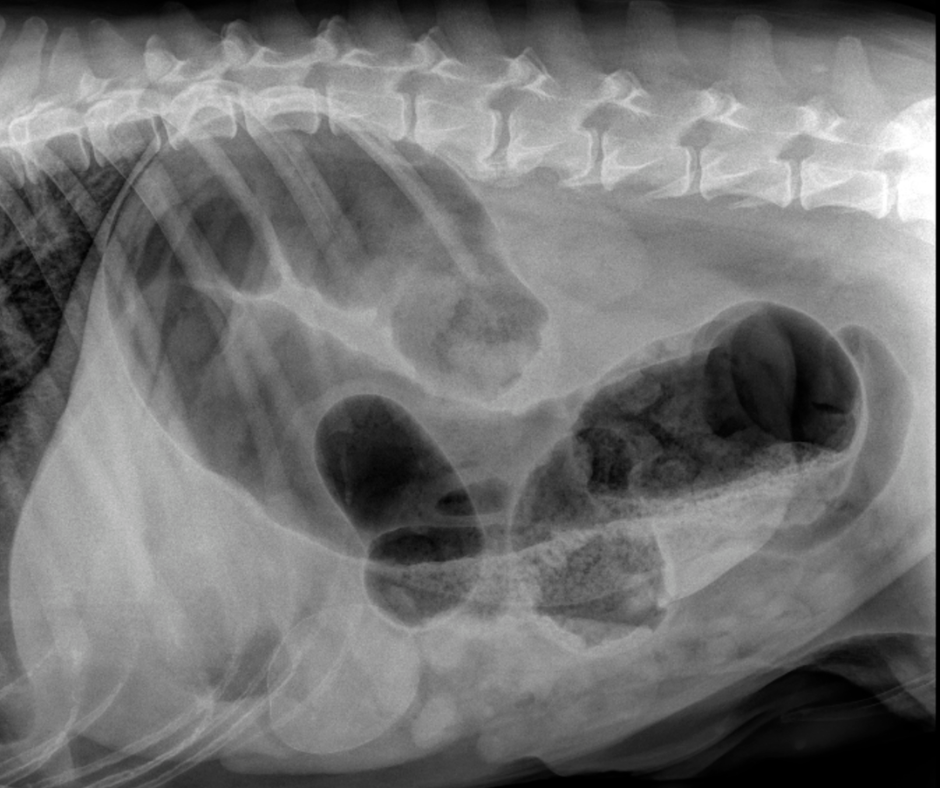 Colonic Lesion 940x788